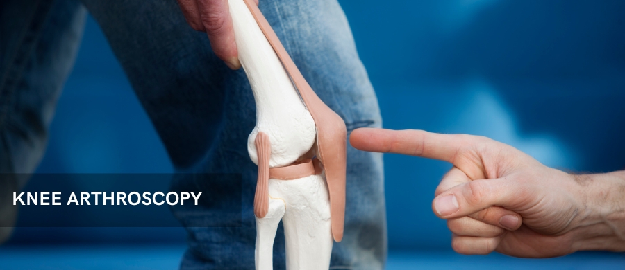 KNEE ARTHROSCOPY